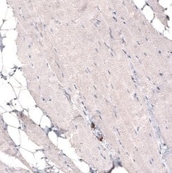 Claudin-1 Antibody (CL3698), Novus Biologicals 100&mu;L:Antibodies, Monoclonal